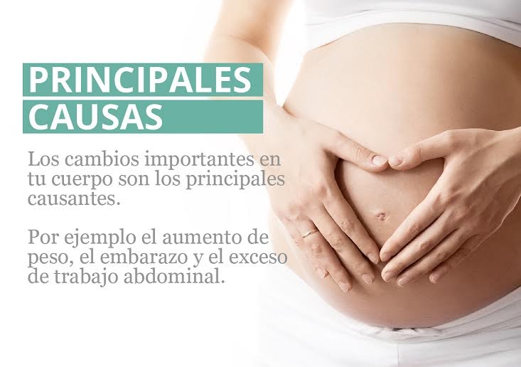 StopDiástasis, una solución que ayuda a las embarazadas a superar la Diástasis con fisioterapia